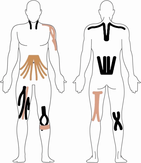 Univerzális alkalmazás az egész testen