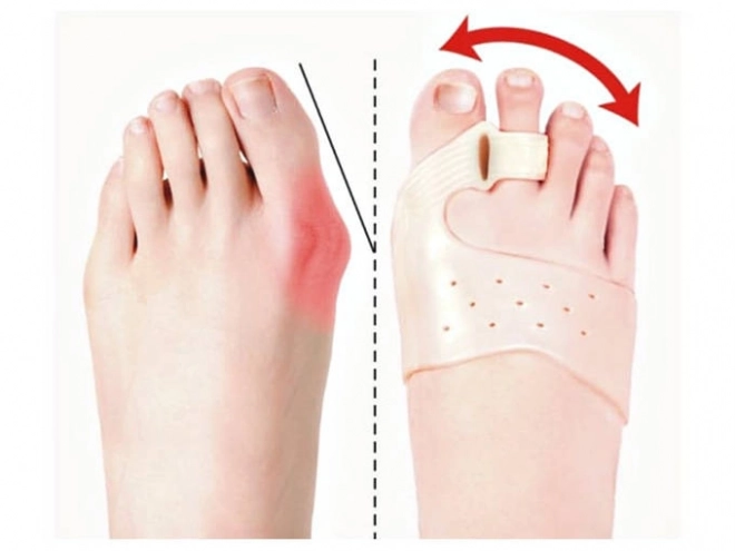 Gel toe separator hallux valgus mágneses ortopédiai szilikon